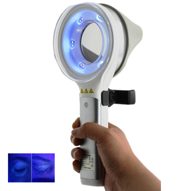 Lampada di Wood a LED KN-9000B - Led Medical Headlight recensione e prezzo